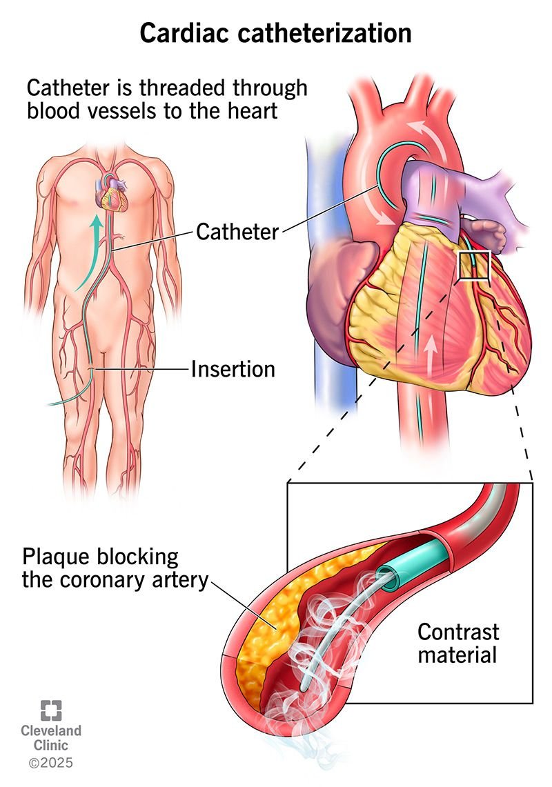 KATH doctor dies over lack of laboratory for treating ‘heart attack’