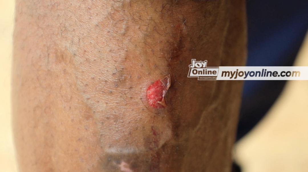 Mob attacks IGP’s special anti-galamsey taskforce at Bonteso in Ashanti region