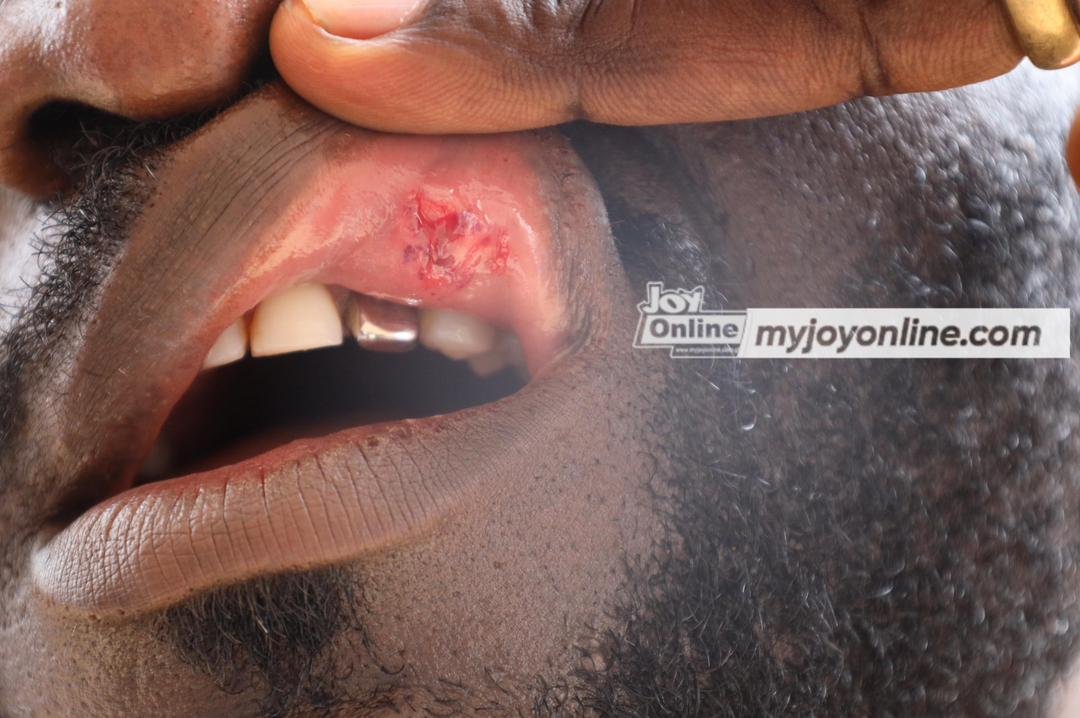 Mob attacks IGP’s special anti-galamsey taskforce at Bonteso in Ashanti region