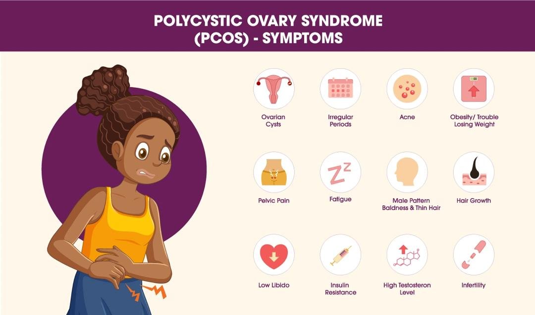"I didn’t know I had PCOS": The silent syndrome affecting young women