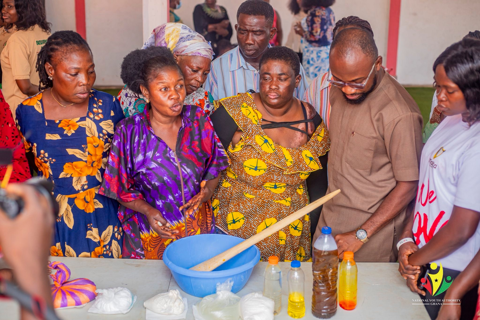 Burn survivors join National Apprenticeship Program with NYA CEO Osman Ayariga’s support