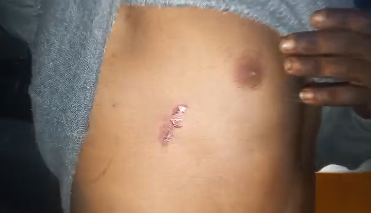 6 injured, 4 arrested after alleged police assault on Kokrobite taxi drivers 6 injured, 4 arrested after alleged police assault on Kokrobite taxi drivers