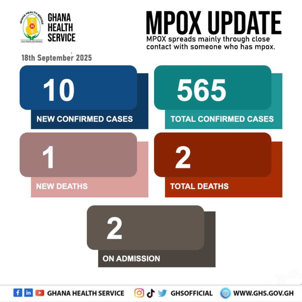 Mpox: Total confirmed cases hit 565 Mpox: Total confirmed cases hit 565