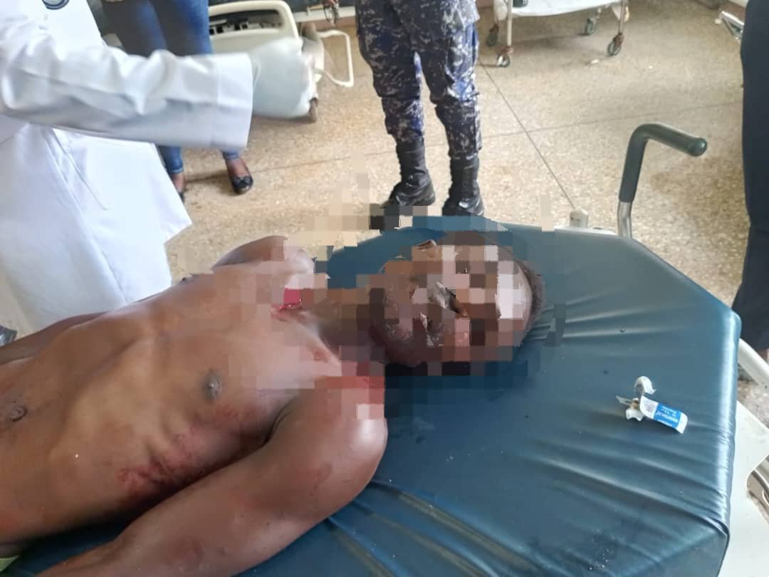 Police arrested man for allegedly stabbing brother to death at Awerempe-Berekum Police arrested man for allegedly stabbing brother to death at Awerempe-Berekum