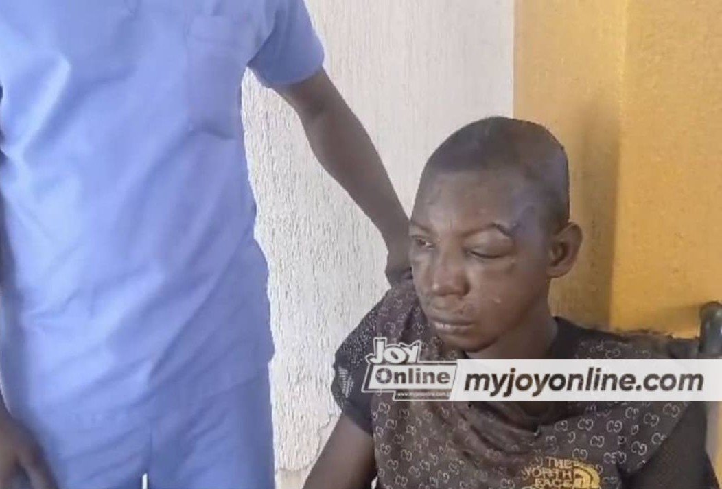 Walewale Municipal Hospital forced to discharge man who was assaulted for alleged attempted theft Walewale Municipal Hospital forced to discharge man who was assaulted for alleged attempted theft