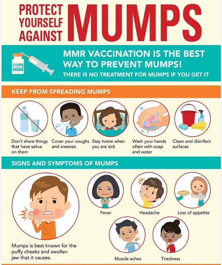 Mumps outbreak hits Keta Township, 50 affected